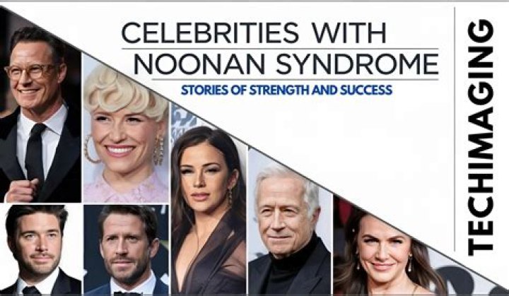 Famous Faces Of Noonan Syndrome: Uncovering The Stories Of Celebrity Resilience