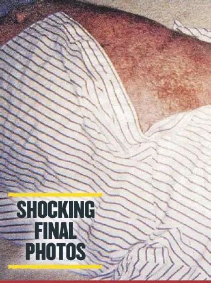 The Tragic Truth: Chris Farley's Autopsy Report Revealed