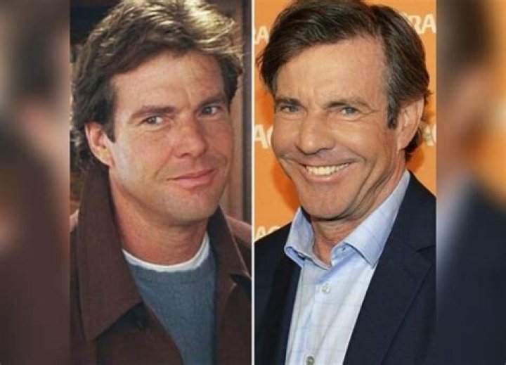 The Definitive Guide To Dennis Quaid's Iconic Nose