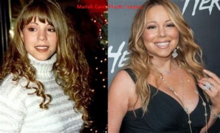 The Truth About Mariah Carey's Alleged Plastic Surgery: A Comprehensive Guide