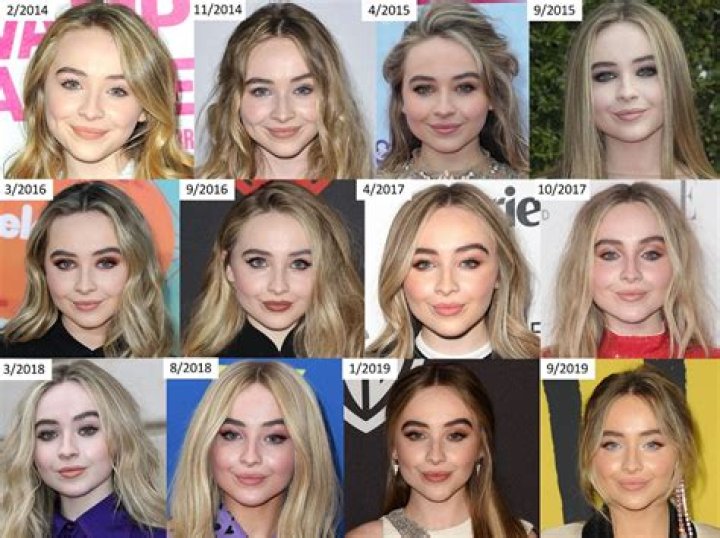 Analyzing Sabrina Carpenter's Transformation: Rumored Plastic Surgery