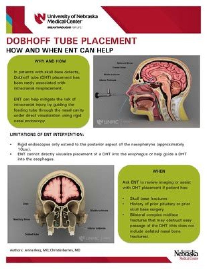 Essential Guide To Dobhoff Tube Placement: Procedure, Benefits, And Risks