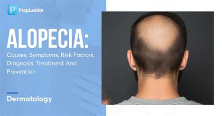 Does Felicia On Big Brother Suffer From Alopecia? Uncovering The Truth