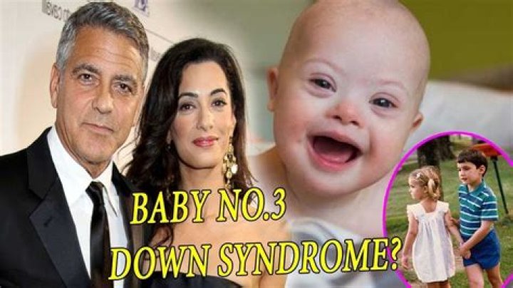 Is George Clooney's Son Affected By Down Syndrome? Uncovering The Truth