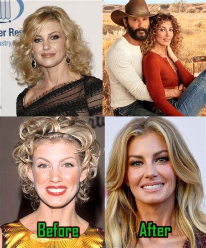 Faith Hill Surgery: An In-Depth Look At The Surgery She Underwent