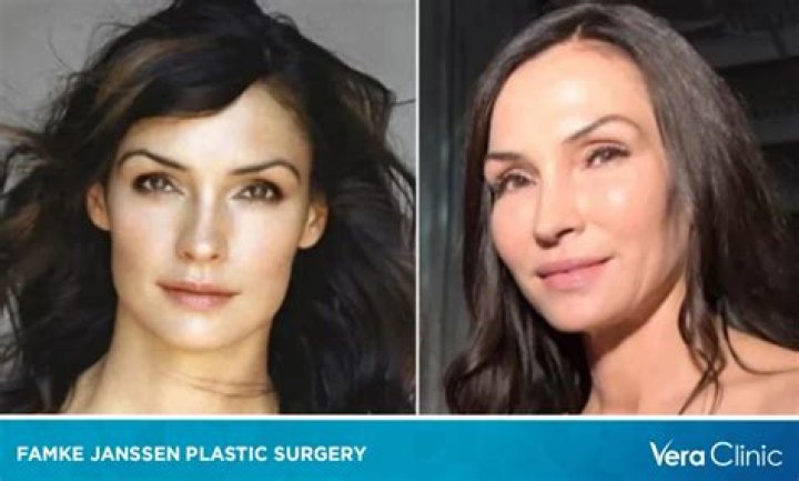 A Deeper Look: Famke Janssen's Plastic Surgery Journey