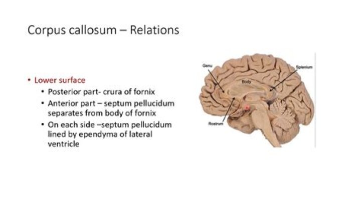 The Essential Role Of The Corpus Callosum: Connecting The Brain
