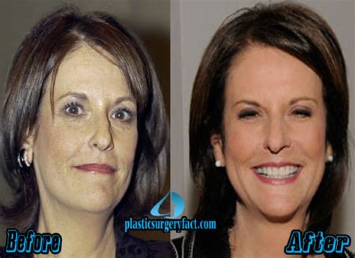 Gloria Borger's Face: A Masterclass In Political Analysis