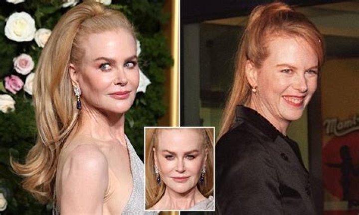 The Truth About Nichole Kidman's Plastic Surgery Speculation
