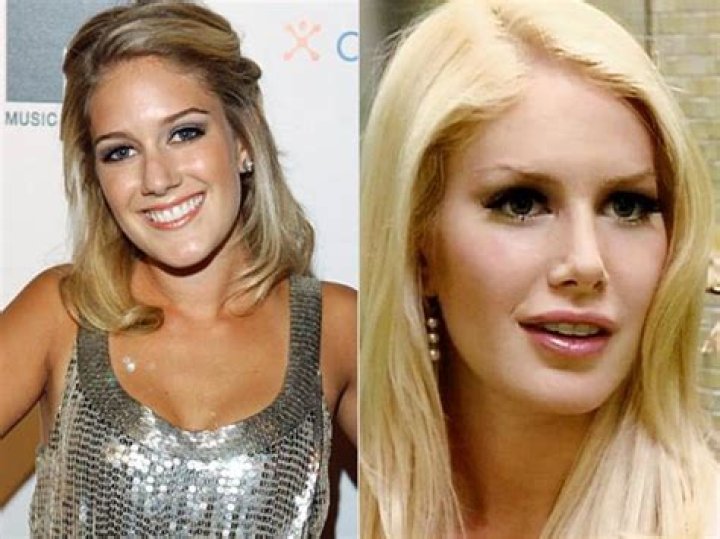 Unrecognizable! The Startling Transformation Of Heidi Montag Before And After