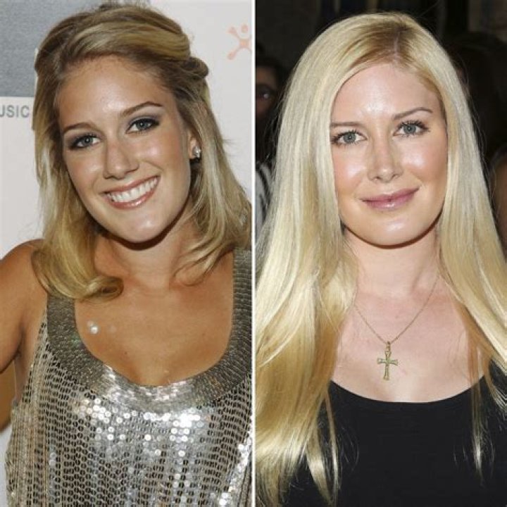 Astonishing Transformation: Heidi Pratt's Journey Before And After