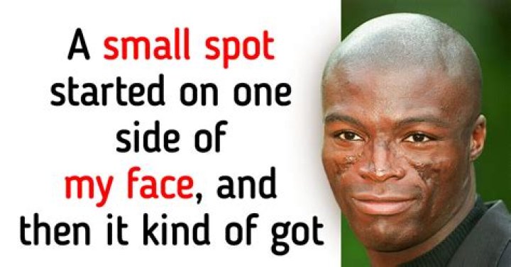 How Seal Earned His Signature Scars: The Untold Story