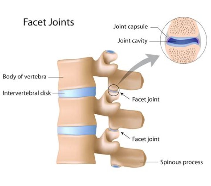 Understanding Hypertrophic Facet Joints: Causes And Management