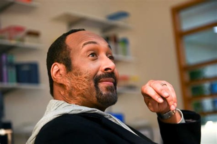 Jesse L. Martin: A Scarred Actor's Journey