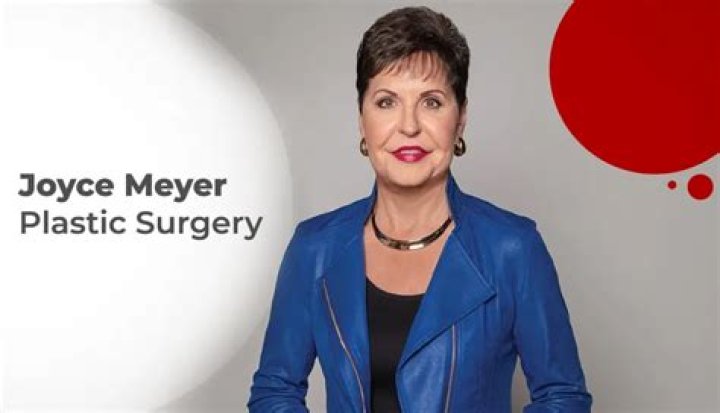 Is Joyce Meyer Hiding A Face Surgery? Uncovering The Truth