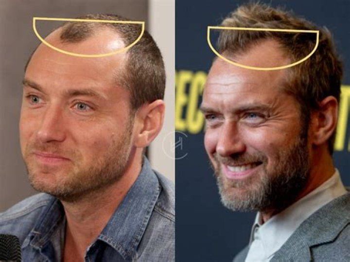 Jude Law's Hair: Iconic Styles And How To Get Them