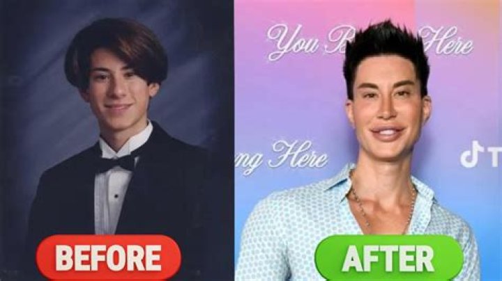 Epic Plastic Surgery Transformation Of Justin Jedlica