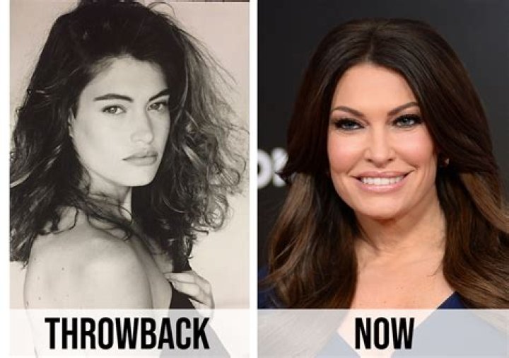Kimberly Guilfoyle: Before And After Plastic Surgery Transformation