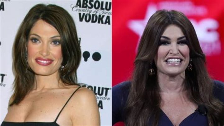Kimberly Guilfoyle's Changing Appearance: Unveiling The Transformative Journey Behind Her Face