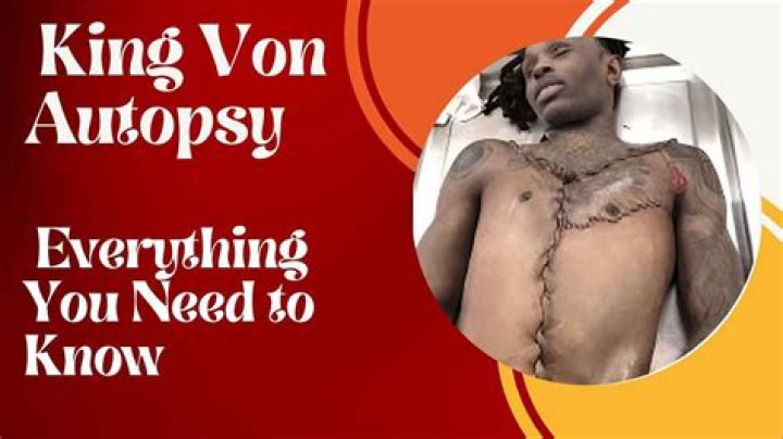 King Von Autopsy: Unraveling The Truth Behind The Tragic Passing