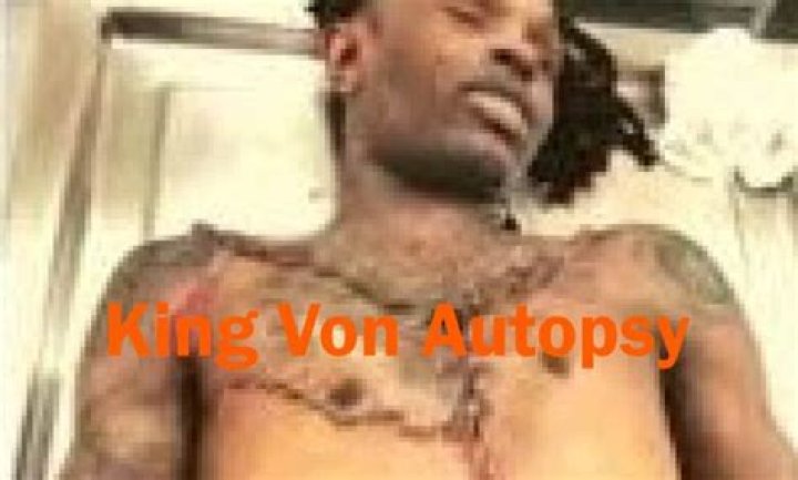 King Von Autopsy Report Released: Shocking Details Uncovered