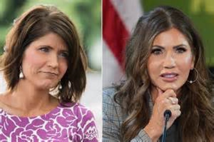 Uncovering The Truth: Governor Kristi Noem's Cosmetic Surgery Rumors
