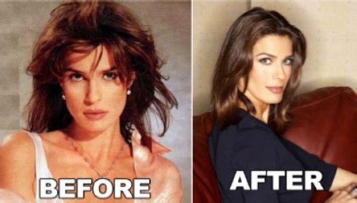 The Ultimate Guide To Kristian Alfonso's Plastic Surgery