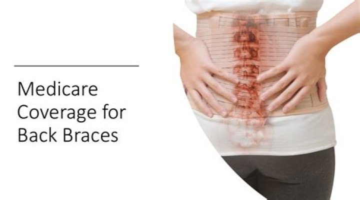 Expert Guide To Medicare Braces Coverage | Comprehensive Information