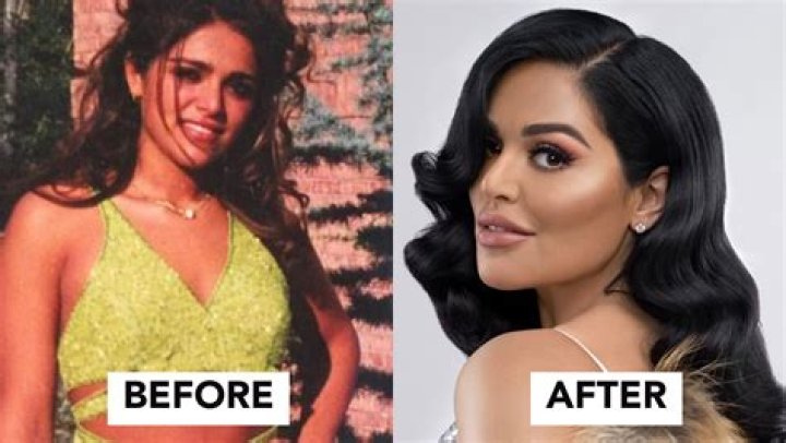 Mona Kattan's Plastic Surgery Journey: Before And After