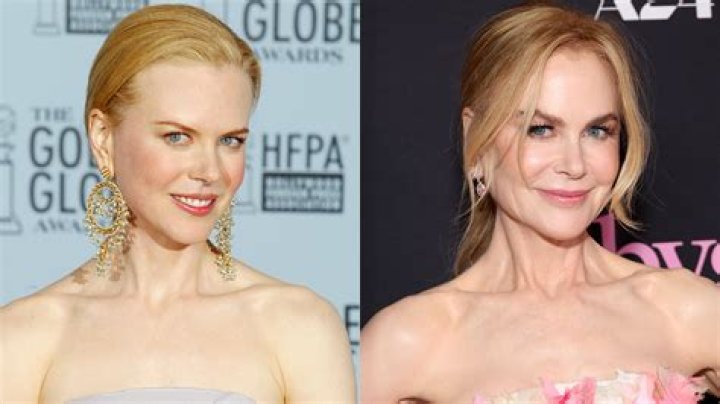 The Truth Behind Nicole Kidman's Plastic Surgery: Fact Or Fiction?