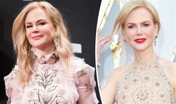 The Intriguing Truth: Nicole Kidman's Plastic Surgery Journey