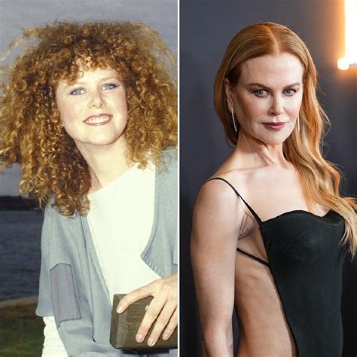 Stunning Transformation: Exploring Nicole Kidman's Journey With Plastic Surgery