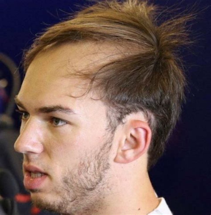 Pierre Gasly Boldly Embraces The Bald Look: An Unconventional Style Statement