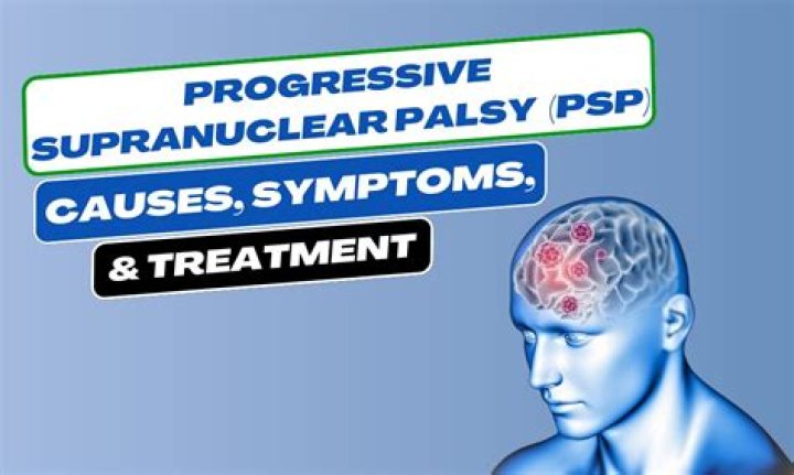Billy Miller's Fight Against Progressive Supranuclear Palsy