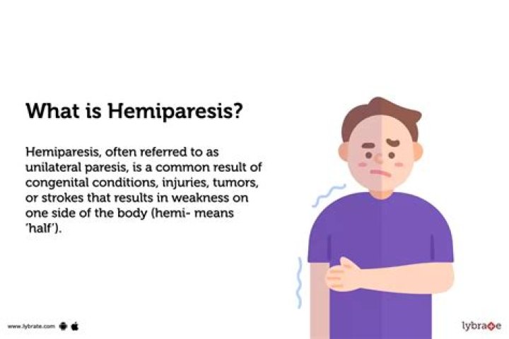 Right-Sided Hemiparesis: Causes, Symptoms, And Treatment