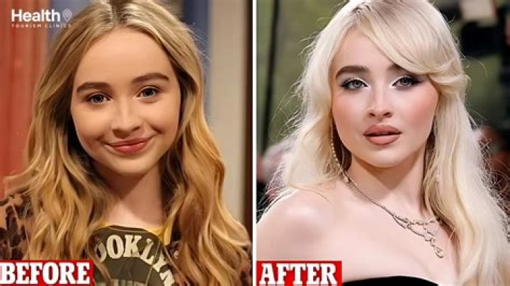Sabrina Carpenter's Transformation: Before And After Plastic Surgery
