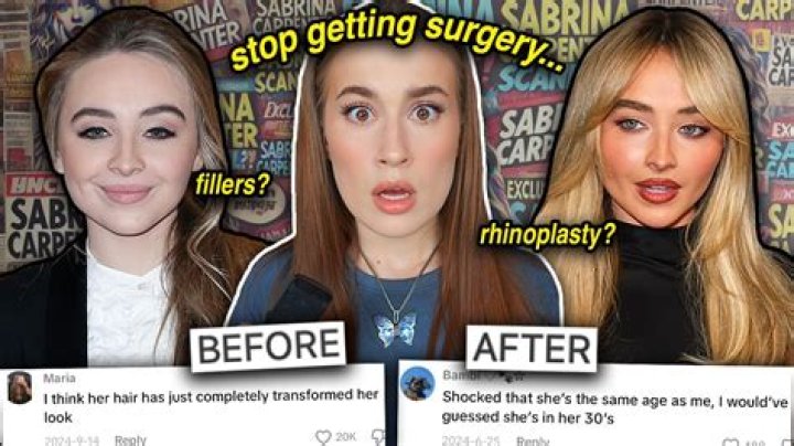 Sabrina Carpenter's Face Filler: The Surprising Truth