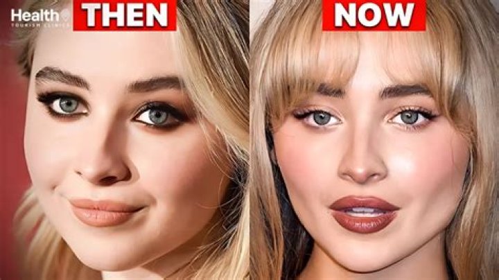 Discover The Truth About Sabrina Carpenter's Lip Filler Rumors