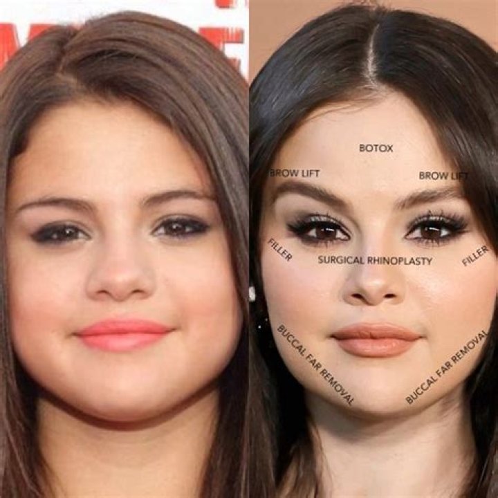The Intriguing Evolution Of Selena Gomez's Facial Features