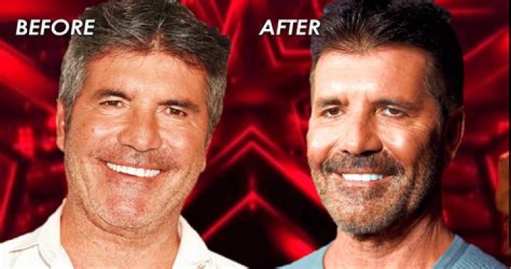 Unveiling The Transformation: Simon Cowell's Pre-Botox Era