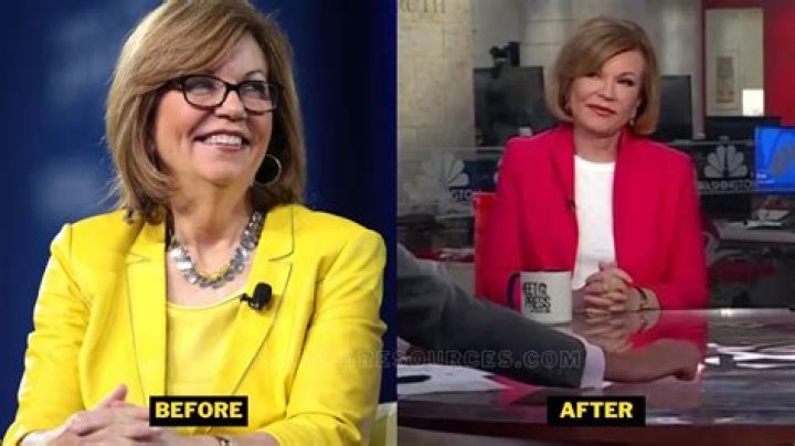 Susan Page's Facelift: Before And After Photos