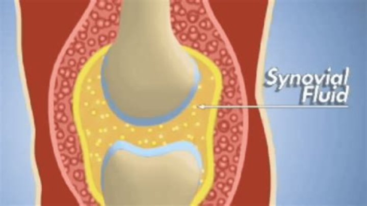 Understanding Synovial Fluid: Its Role And Importance
