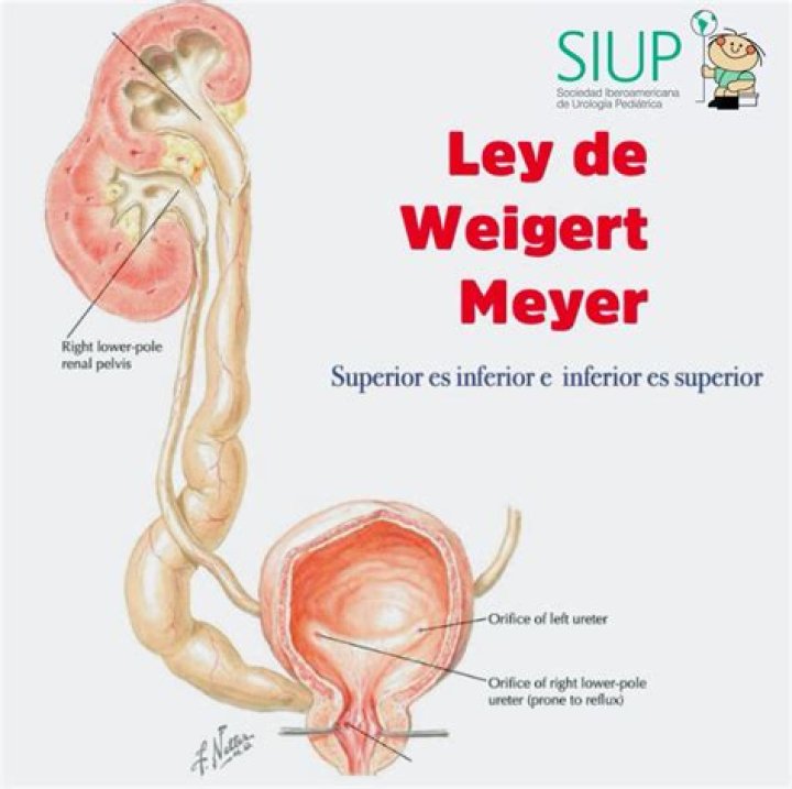 Teri Weigert: The Tech Leader Transforming The Industry