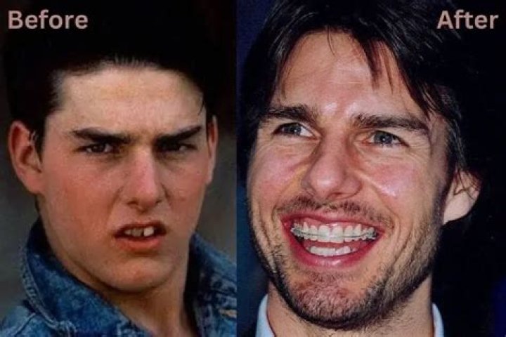 Unmasking Tom Cruise's Notorious Teeth: A Candid Examination