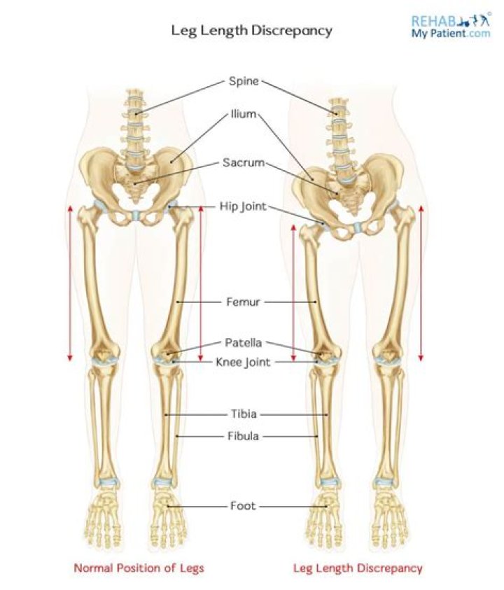 The Ultimate Guide To Understanding Upper Leg-to-Lower Leg Length Ratio