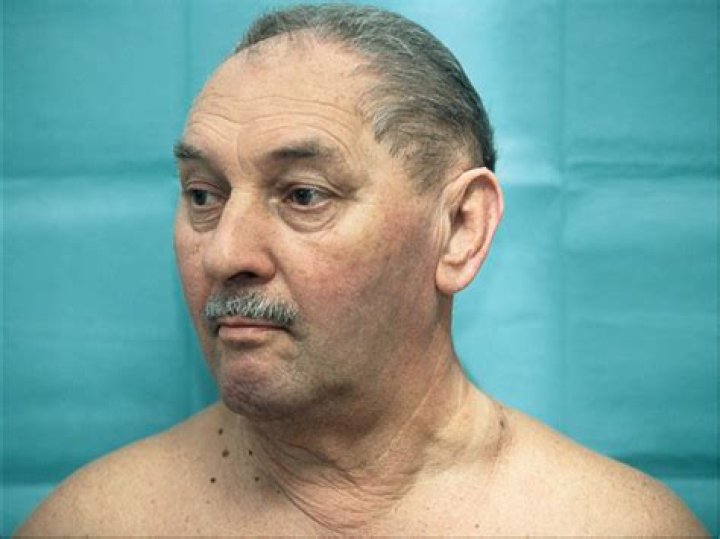 Virchow's Sign: A Guide To Recognizing And Treating Venous Insufficiency