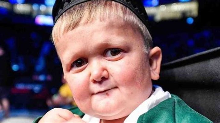 Understanding Hasbulla's Unique Medical Condition