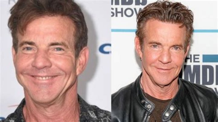 What's Behind Dennis Quaid's Face Transformation?