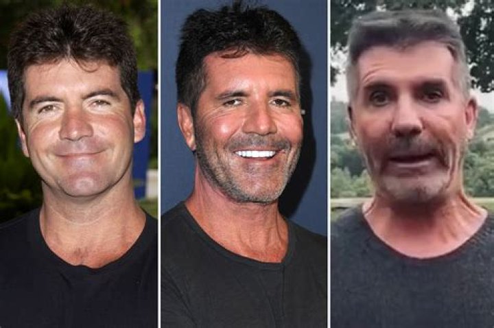 What's Behind Simon Cowell's Son Eric's Unusual Appearance