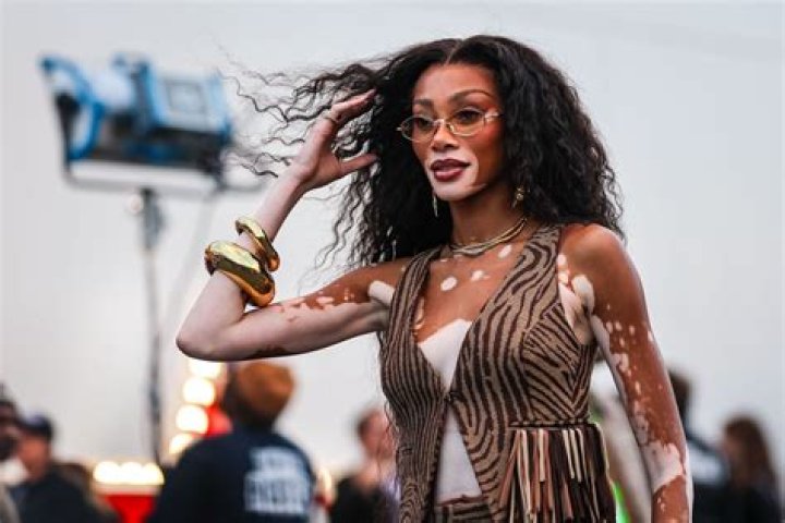 Winnie Harlow: A Model's Fortune Explored